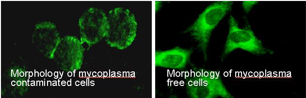 mycoplasma contamination in cell culture